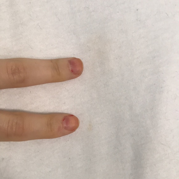 Spina Bifida t shirt, size medium - Picture 3 of 6